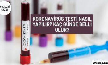 Koronavirüs Testi Nasıl Yapılır? Test Sonucu Ne zaman Çıkar?